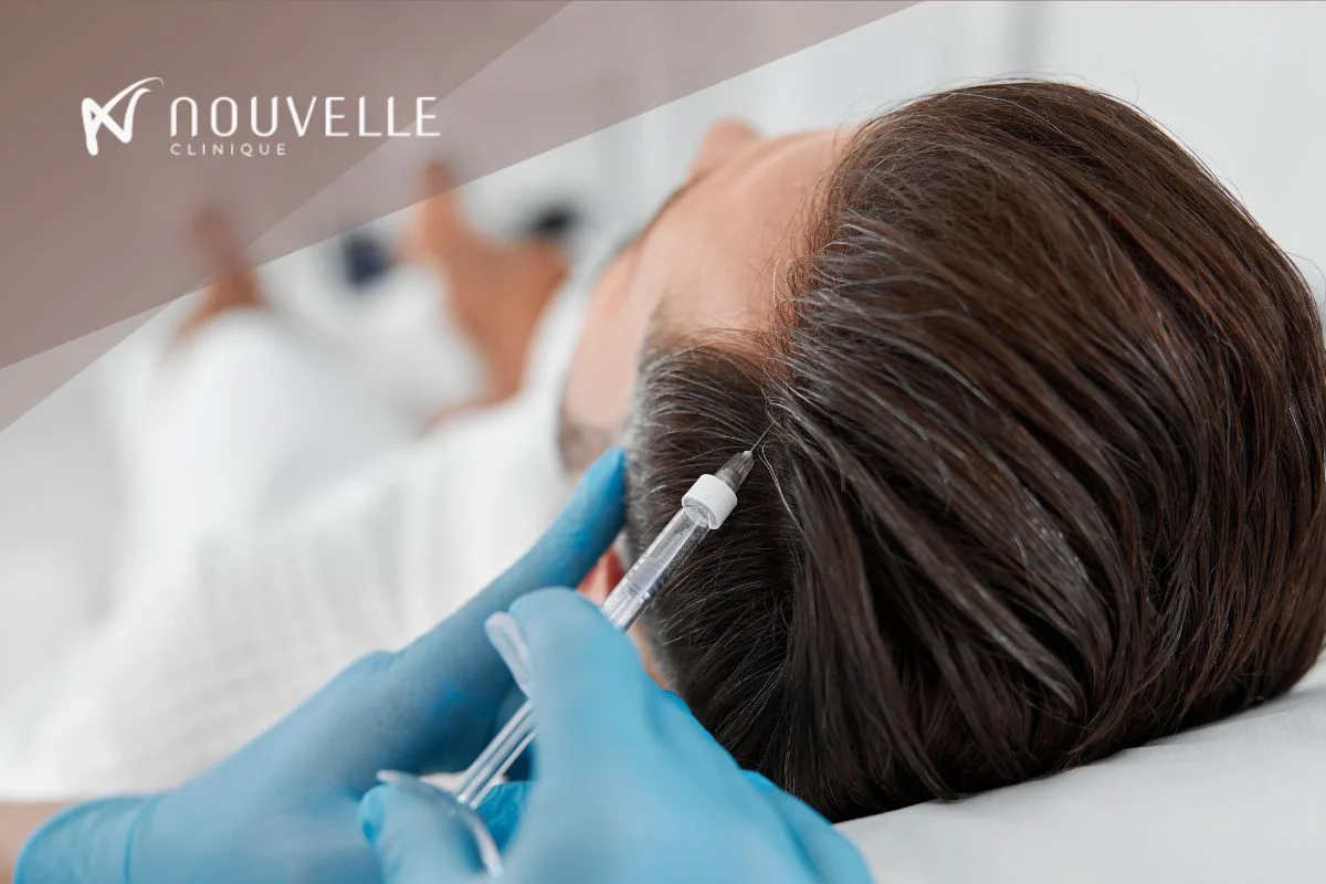 Best Clinic for PRP hair Albania - Nouvelle Clinique