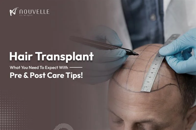 DHE hair transplant technique at Nouvelle Clinique